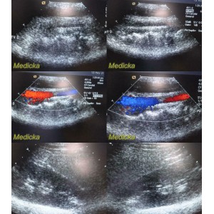 https://www.themedicka.com/10057-111636-thickbox/siemens-acuson-4v1-p-n-08252072-vector-array-ultrasound-transducer-24839.jpg