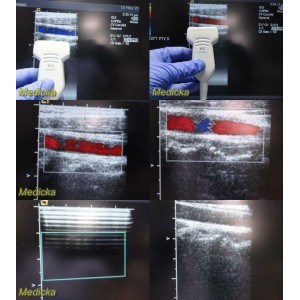 https://www.themedicka.com/10062-111696-thickbox/acuson-8l5-ultrasound-transducer-probe-linear-array-24841.jpg