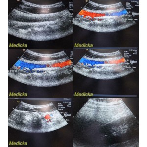 https://www.themedicka.com/10063-111708-thickbox/acuson-model-8c4-convex-array-ultrasound-transducer-probe-24838.jpg