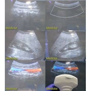 https://www.themedicka.com/10064-111720-thickbox/siemens-ch4-1-convex-array-ultrasound-transducer-probe-24908.jpg