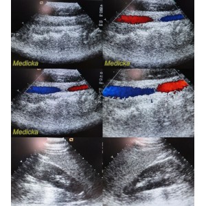 https://www.themedicka.com/10066-111744-thickbox/acuson-4v1-vector-array-ultrasound-transducer-probe-tested-working-24905.jpg