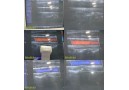 Siemens VFX13-5 Multi-D Linear Array Ultrasound Transducer Probe(04838863)~24899