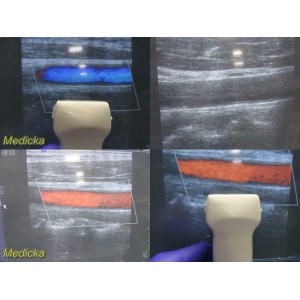 https://www.themedicka.com/10074-111828-thickbox/siemens-sonoline-antares-vfx13-5-multi-d-linear-array-ultrasound-probe-24895.jpg