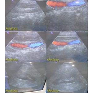 https://www.themedicka.com/10079-111888-thickbox/siemens-ph4-1-sector-array-ultrasound-transducer-probe-model-7466910-24915.jpg