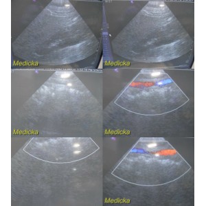 https://www.themedicka.com/10080-111900-thickbox/siemens-ph4-1-07468910-phased-array-ultrasound-transducer-probe-24913.jpg