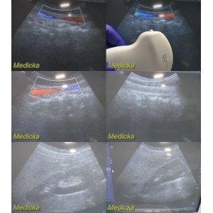 https://www.themedicka.com/10081-111912-thickbox/siemens-sonoline-antares-c5-2-model-04839465-convex-array-ultrasound-probe24911.jpg