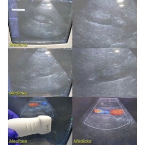 https://www.themedicka.com/10083-111935-thickbox/siemens-ph4-1-7466910-phased-array-ultrasound-transducer-probe-24909.jpg