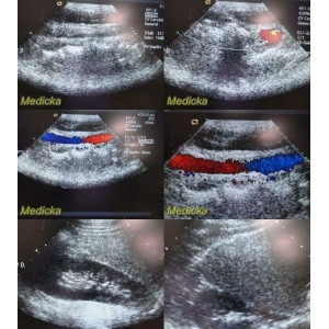 https://www.themedicka.com/10125-112416-thickbox/2011-acuson-siemens-4v1-sector-array-ultrasound-transducer-probe0825207224859.jpg