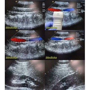 https://www.themedicka.com/10130-112476-thickbox/acuson-siemens-4v1-p-n-08252072-vector-array-ultrasound-transducer-probe-24854.jpg