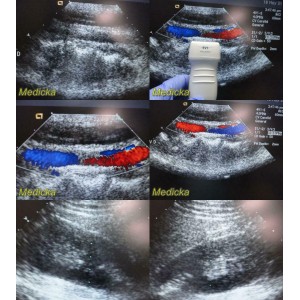 https://www.themedicka.com/10138-112572-thickbox/2012-siemens-acuson-p-n-08257869-4v1-phased-array-ultrasound-transducer-24870.jpg