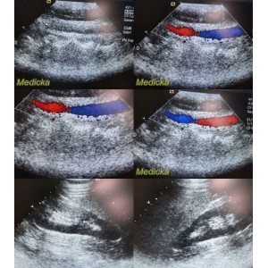 https://www.themedicka.com/10139-112584-thickbox/2009-acuson-siemens-4v1-p-n-08257869-sector-array-ultrasound-transducer-24875.jpg