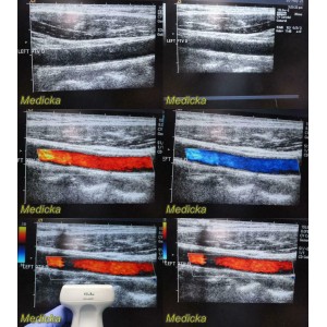 https://www.themedicka.com/10146-112668-thickbox/siemens-acuson-15l8w-linear-array-ultrasound-transducer-probe-tested-24889.jpg