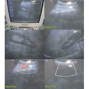 https://www.themedicka.com/10147-112680-thickbox/2005-siemens-ch4-1-convex-array-ultrasound-transducer-probe-tested-24888.jpg