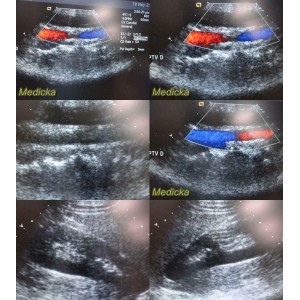 https://www.themedicka.com/10159-112818-thickbox/siemens-acuson-08252072-4v1-phased-array-ultrasound-transducer-probe-24879.jpg