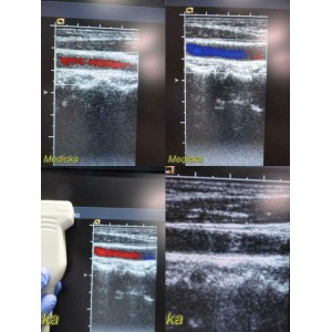 https://www.themedicka.com/10164-112878-thickbox/2006-acuson-6l3-model-08241112-linear-array-ultrasound-transducer-probe-24719.jpg