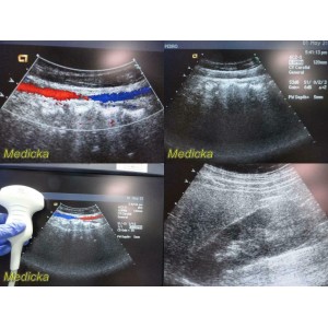 https://www.themedicka.com/10165-112890-thickbox/siemens-acuson-6c2-convex-array-ultrasound-transducer-probe-tested-24718.jpg