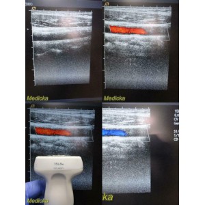 https://www.themedicka.com/10174-112998-thickbox/2005-acuson-15l8w-linear-array-ultrasound-transducer-probe-model-08241113-24706.jpg