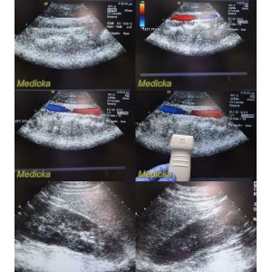 https://www.themedicka.com/10188-113162-thickbox/2007-acuson-4v1-08257869-phased-array-ultrasound-transducer-probe-24809.jpg