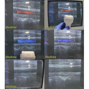 https://www.themedicka.com/10190-113186-thickbox/siemens-medical-sonoline-antares-vf10-5-linear-array-ultrasound-probe-24803.jpg