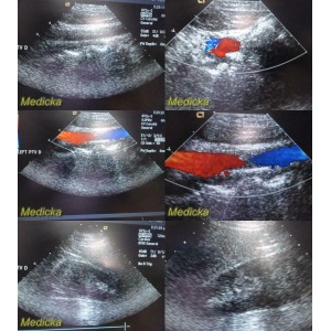 https://www.themedicka.com/10194-113234-thickbox/2008-acuson-8v3-p-n-07695740-phased-array-ultrasound-transducer-probe-24799.jpg