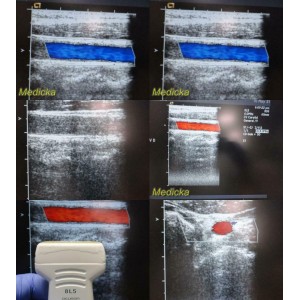 https://www.themedicka.com/10203-113325-thickbox/acuson-linear-array-8l5-ultrasound-transducer-probe-24818.jpg