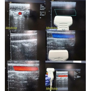 https://www.themedicka.com/10204-113337-thickbox/acuson-model-8l5-linear-array-ultrasound-transducer-probe-24821.jpg