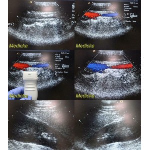 https://www.themedicka.com/10206-113361-thickbox/acuson-4v1-vector-array-ultrasound-transducer-probe-24819.jpg