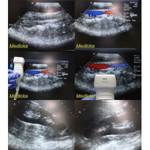 https://www.themedicka.com/10207-113373-thickbox/2013-acuson-4v1-phased-array-ultrasound-transducer-probe-08257869-24817.jpg