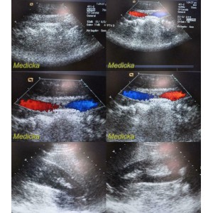 https://www.themedicka.com/10209-113397-thickbox/2011-acuson-4v1-p-n-08257869-vector-array-ultrasound-transducer-w-case-24811.jpg