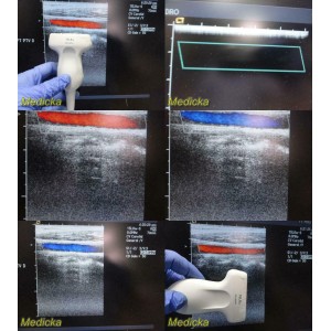 https://www.themedicka.com/10216-113468-thickbox/acuson-model-15l8w-linear-array-ultrasound-transducer-probe-24835.jpg