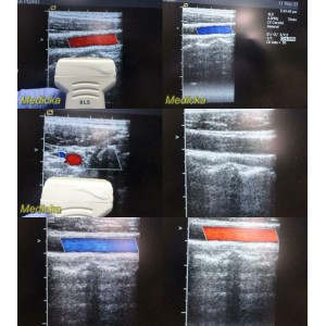 https://www.themedicka.com/10217-113480-thickbox/acuson-model-8l5-linear-array-ultrasound-transducer-probe-24833.jpg