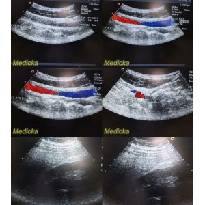 https://www.themedicka.com/10221-113527-thickbox/acuson-8c4-convex-array-ultrasound-transducer-probe-tested-working-24828.jpg