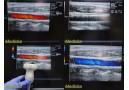 Acuson 15L8W Linear Array Ultrasound Transducer Probe P/N 08241113 ~ 24827