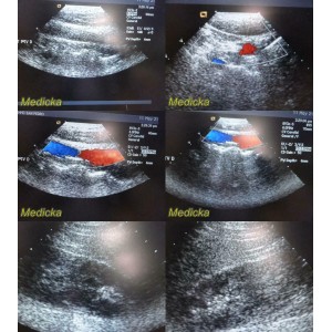 https://www.themedicka.com/10223-113551-thickbox/2006-siemens-acuson-8v3-ref-07695740-phased-ultrasound-transducer-probe-24826.jpg