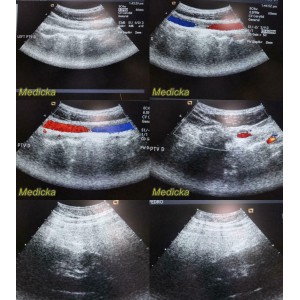 https://www.themedicka.com/10226-113587-thickbox/2009-siemens-medical-acuson-8c4-convex-array-ultrasound-transducer-probe-24823.jpg