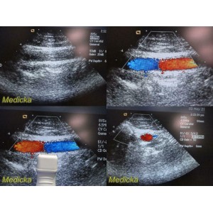 https://www.themedicka.com/10232-113659-thickbox/acuson-8v5-sector-array-ultrasound-transducer-probe-p-n-08241114-24732.jpg