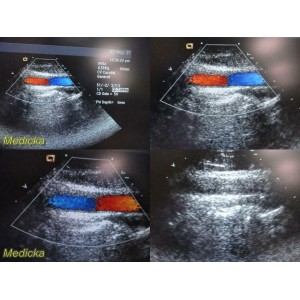 https://www.themedicka.com/10239-113743-thickbox/2009-acuson-8v5-p-n-08247448-sector-array-ultrasound-transducer-probe-24725.jpg