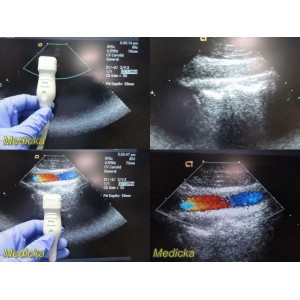 https://www.themedicka.com/10244-113803-thickbox/acuson-8v5-vector-array-ultrasound-transducer-probe-tested-working-24751.jpg