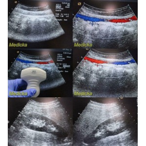 https://www.themedicka.com/10246-113827-thickbox/acuson-model-6c2-convex-array-ultrasound-transducer-probe-24749.jpg