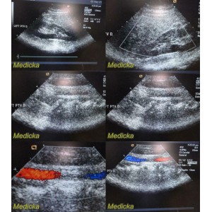 https://www.themedicka.com/10251-113887-thickbox/acuson-4v2-phased-array-ultrasound-transducer-probe-24764.jpg