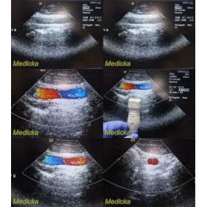 https://www.themedicka.com/10252-113899-thickbox/acuson-model-8v5-sector-array-ultrasound-transducer-probe-24759.jpg