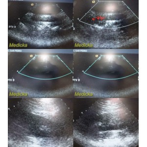 https://www.themedicka.com/10254-113923-thickbox/acuson-4v1-vector-array-ultrasound-transducer-probe-24765.jpg