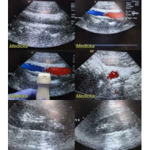 https://www.themedicka.com/10256-113947-thickbox/2007-siemens-acuson-8v3-p-n-07695740-vector-array-ultrasound-transducer-24762.jpg