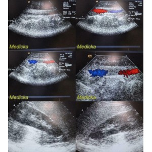 https://www.themedicka.com/10257-113959-thickbox/2009-siemens-acuson-4v1-vector-array-ultrasound-transducer-probe-24761.jpg