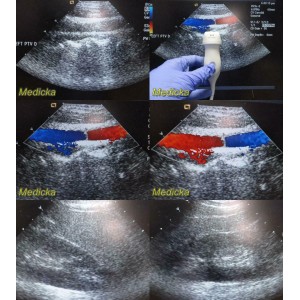 https://www.themedicka.com/10260-113995-thickbox/2008-acuson-8v3-p-n-07695740-vector-array-ultrasound-transducer-probe-24786.jpg