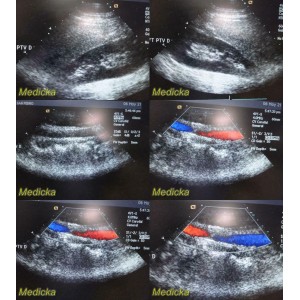 https://www.themedicka.com/10264-114043-thickbox/acuson-4v1-model-08252072-vector-array-ultrasound-transducer-probe-24782.jpg