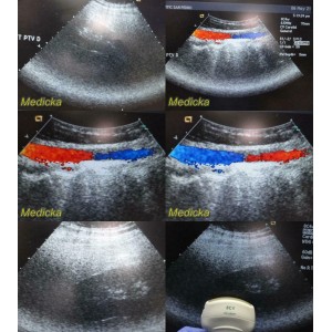 https://www.themedicka.com/10265-114055-thickbox/acuson-8c4-convex-array-ultrasound-transducer-probe-24781.jpg