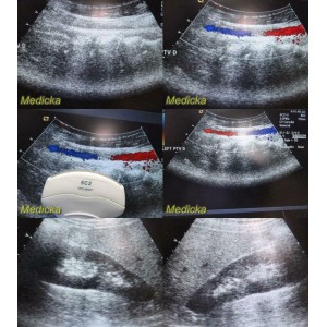 https://www.themedicka.com/10267-114079-thickbox/siemens-acuson-6c2-082659645-convex-array-ultrasound-transducer-probe-24778.jpg