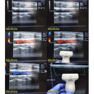 https://www.themedicka.com/10268-114091-thickbox/acuson-15l8w-linear-array-ultrasound-probe-24776.jpg