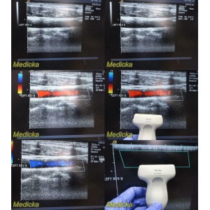 https://www.themedicka.com/10268-114091-thickbox/acuson-15l8w-linear-array-ultrasound-probe-24776.jpg